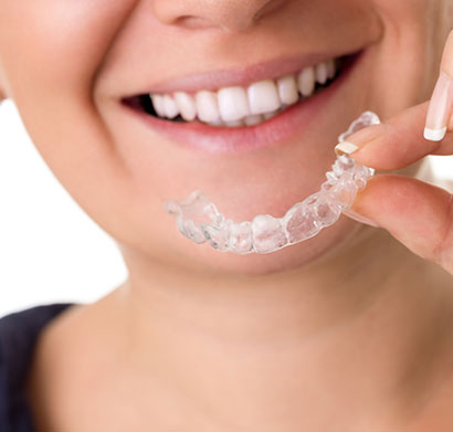 Cavity prevention with Invisalign