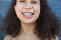 NCOSO Female Teen with Braces