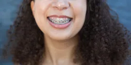 NCOSO Female Teen with Braces