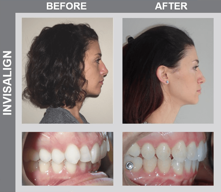 Smile Gallery, Before and Afters